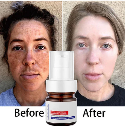 Vitamin C Whitening Freckles ESSENCE