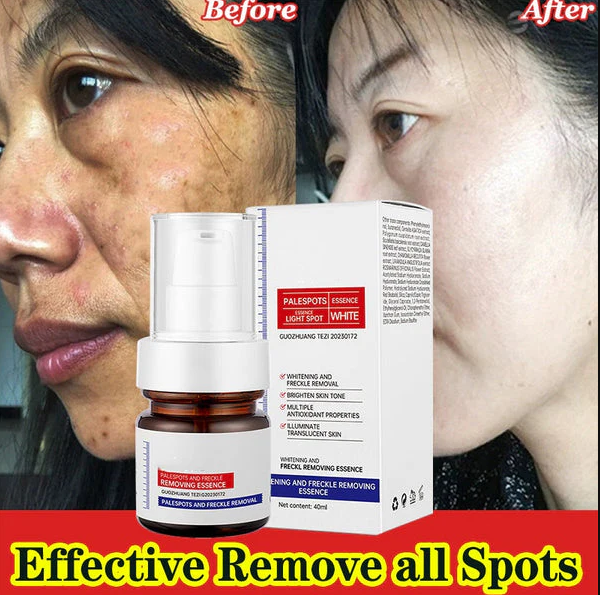 Vitamin C Whitening Freckles ESSENCE